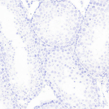 CD8α Recombinant Rabbit mAb (S-6201)