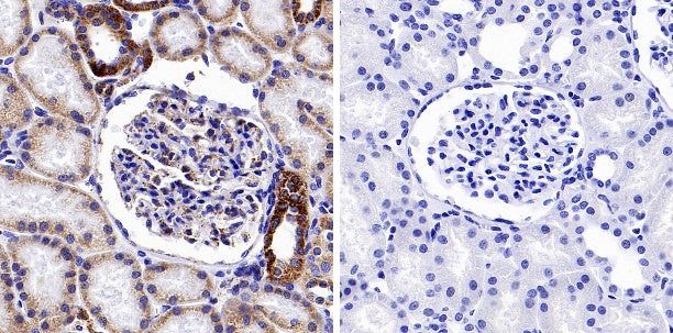 Phospho-PDHA1 (S293) Recombinant Rabbit mAb (S-1729-25)