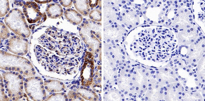 Phospho-PDHA1 (S293) Recombinant Rabbit mAb (S-1729-25)