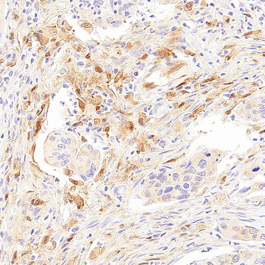 Galectin-9 Recombinant Rabbit mAb (S-4579-67)