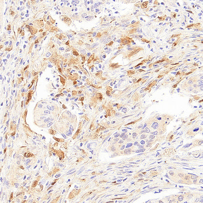 Galectin-9 Recombinant Rabbit mAb (S-4579-67)