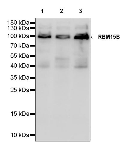 RBM15B Recombinant Rabbit mAb (S-1326-111)