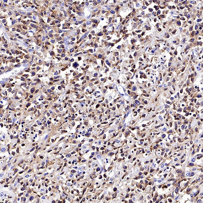CD94 Recombinant Rabbit mAb (S-2616-5)