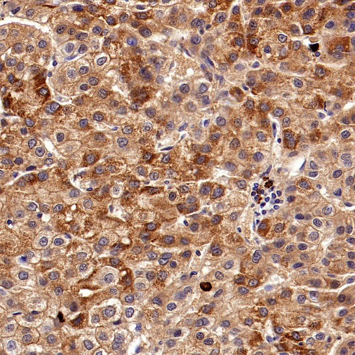 ART1 Recombinant Rabbit mAb (S-2396-1)