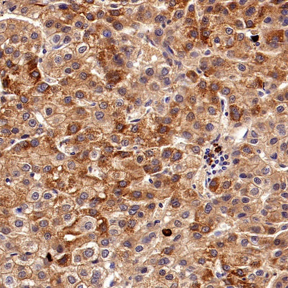 ART1 Recombinant Rabbit mAb (S-2396-1)