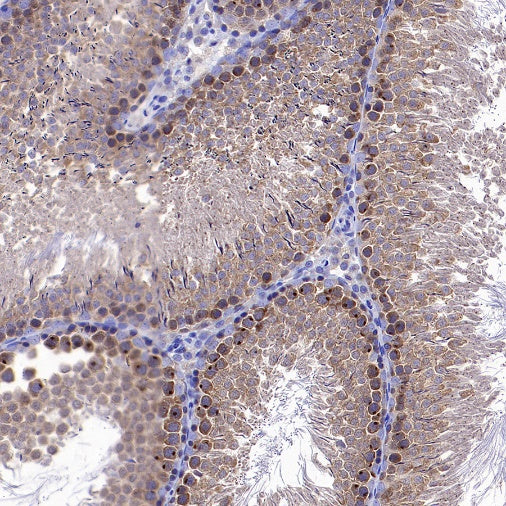 gamma Tubulin Recombinant Rabbit mAb (S-2204-13)