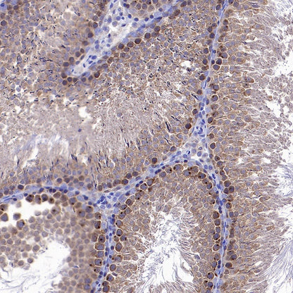 gamma Tubulin Recombinant Rabbit mAb (S-2204-13)