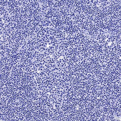 MRP2 Recombinant Rabbit mAb (S-2316-41)