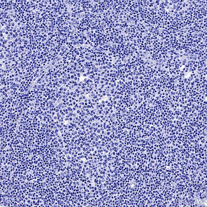 MRP2 Recombinant Rabbit mAb (S-2316-41)