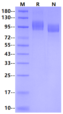 Soluble Amyloid-β/APP(18-652) His Tag Protein, Human