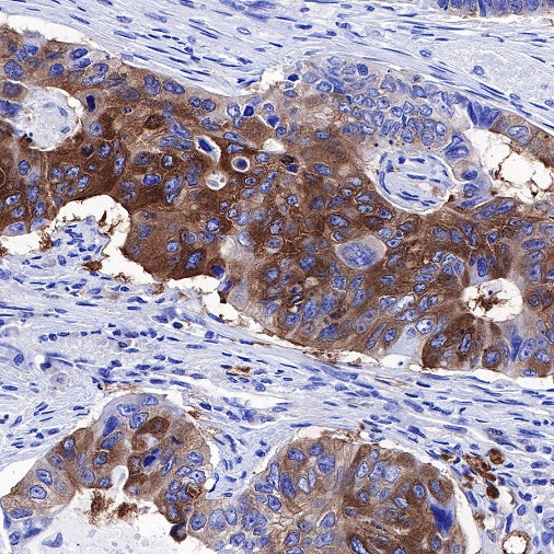 FASN Recombinant Rabbit mAb (S-682-32)