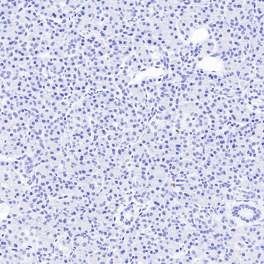 BACH2 Rabbit Polyclonal Antibody