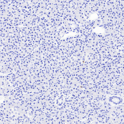 BACH2 Rabbit Polyclonal Antibody
