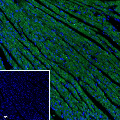 ADRB2 Recombinant Rabbit mAb (S-2418-144)