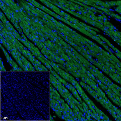 ADRB2 Recombinant Rabbit mAb (S-2418-144)