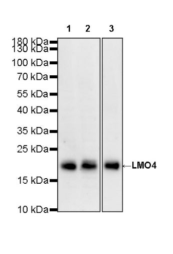 LMO4 Recombinant Rat mAb (S-5963)