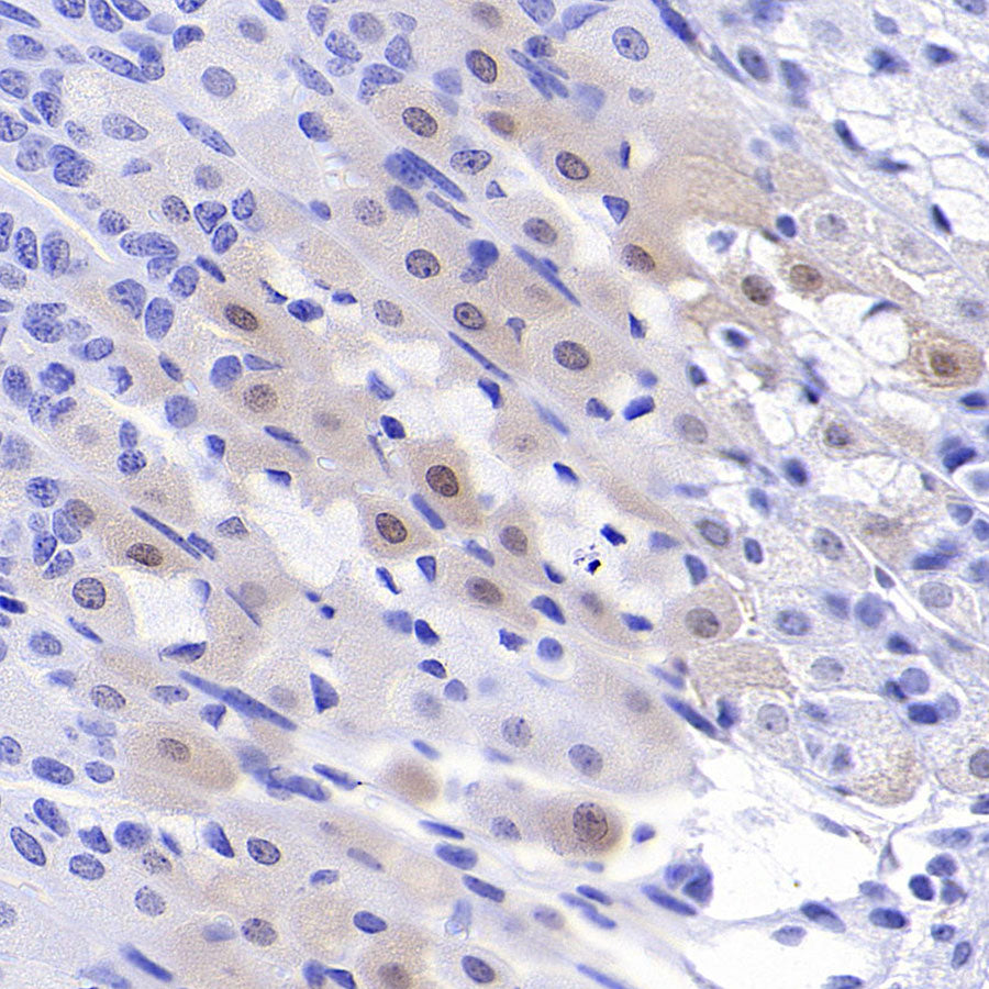 Phospho-p44/42 MAPK (Erk1/2) (Thr202/Tyr204) Recombinant Rabbit mAb (S-5119)