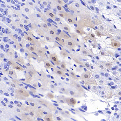 Phospho-p44/42 MAPK (Erk1/2) (Thr202/Tyr204) Recombinant Rabbit mAb (S-5119)