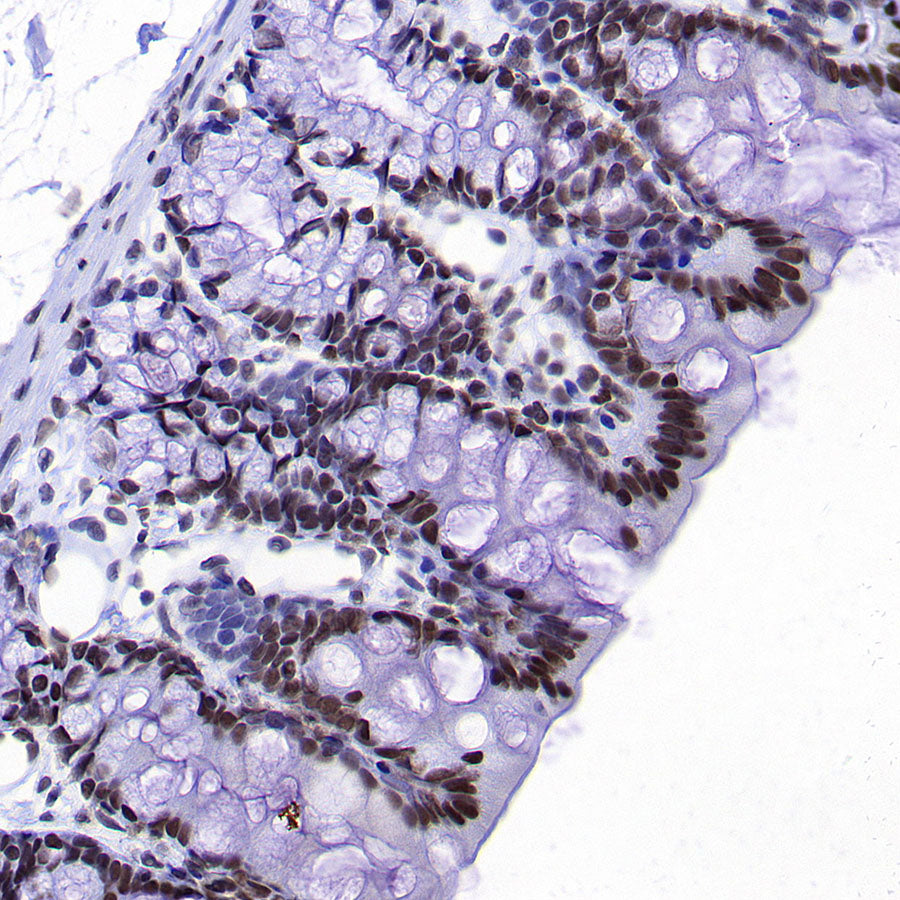 HNRNPA2B1 Mouse mAb