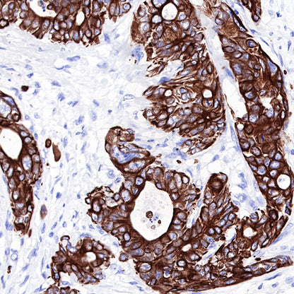 S-RMab® CK-Pan Recombinant Rabbit mAb,PBS Only (SDT-P001)