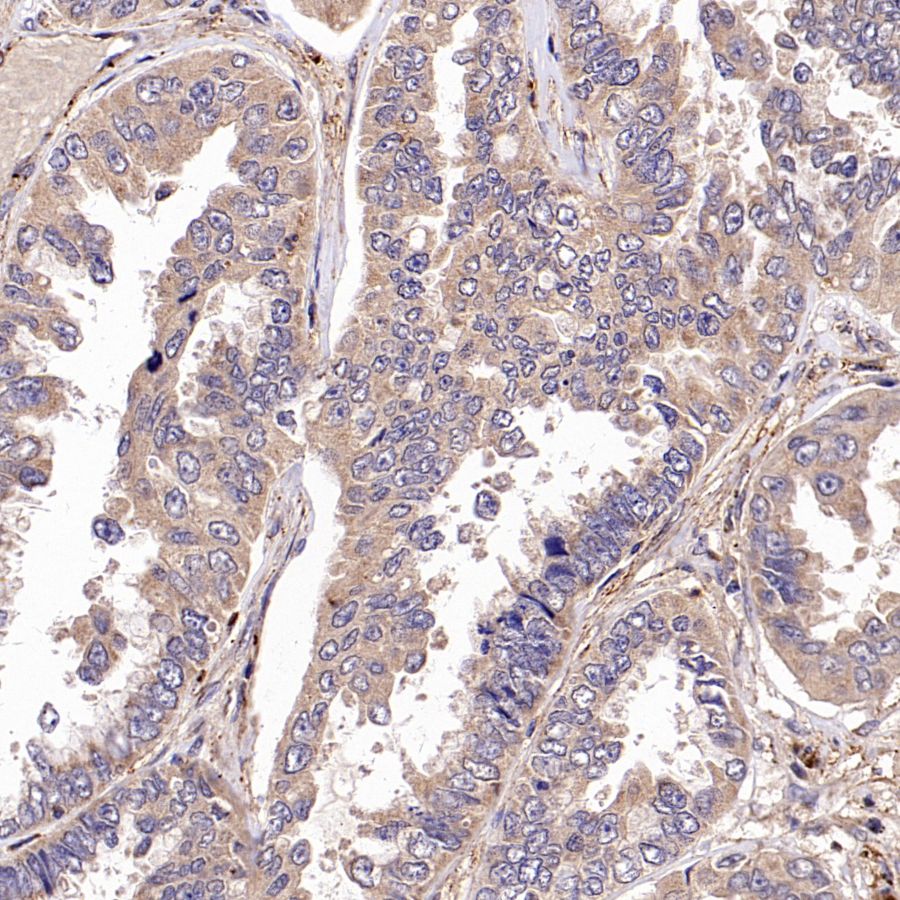 TYK2 Recombinant Rabbit mAb (S-2740-165)