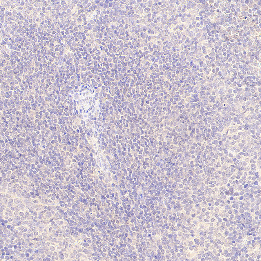 GABA A Receptor alpha 5/GABRA5 Recombinant Rabbit mAb (S-6030)