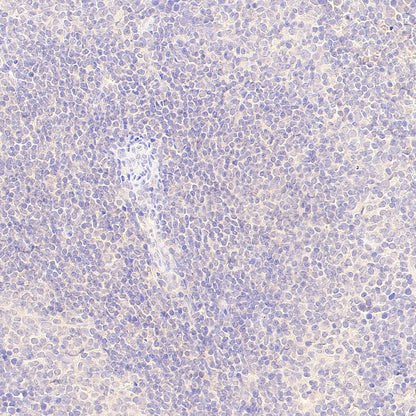 GABA A Receptor alpha 5/GABRA5 Recombinant Rabbit mAb (S-6030)