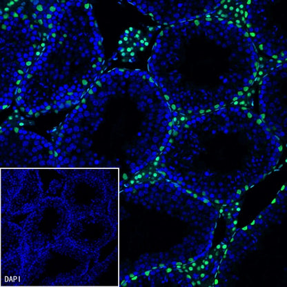 GATA4 Recombinant Rabbit mAb (S-1428-141)