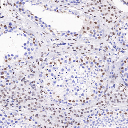 Androgen Receptor Recombinant Rabbit mAb (SDT-R167)