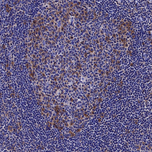 S6 Ribosomal Protein Recombinant Rabbit mAb (S-479-1)