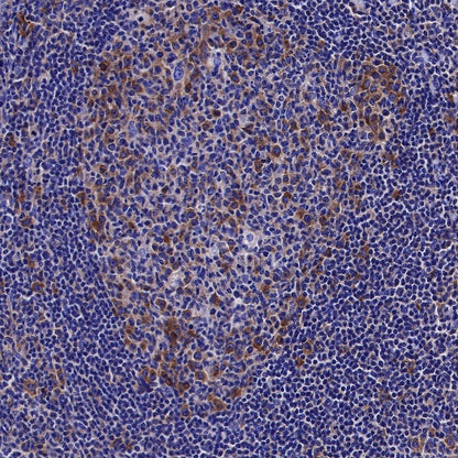 S6 Ribosomal Protein Recombinant Rabbit mAb (S-479-1)