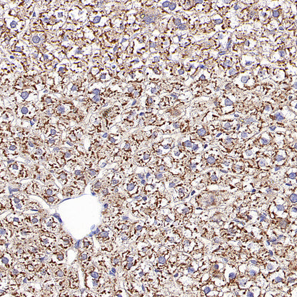 RPLP0 Rabbit Polyclonal Antibody