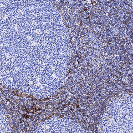 CCR7 Recombinant Rabbit mAb (S-999-29)