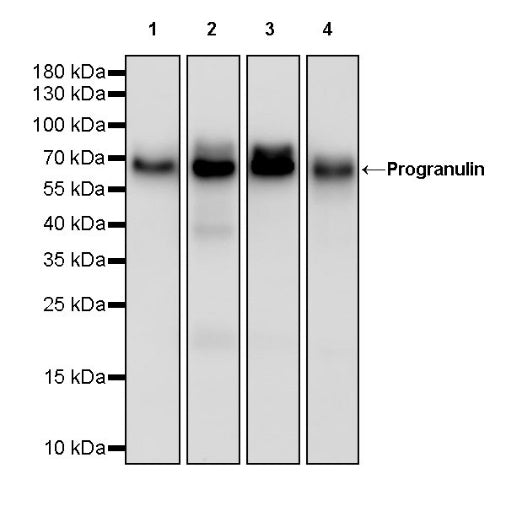 Progranulin Recombinant Rabbit mAb (S-2202-46)
