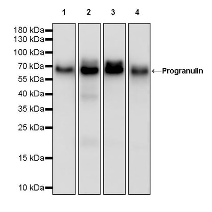 Progranulin Recombinant Rabbit mAb (S-2202-46)