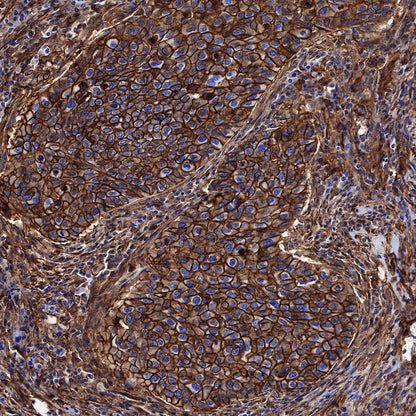 S-RMab®Annexin A2 Recombinant Rabbit mAb (SDT-444-67)