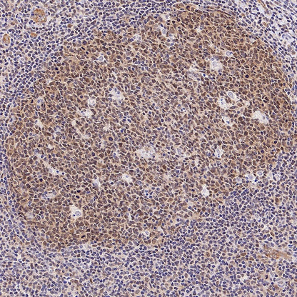 Caspase-2 Recombinant Rabbit mAb (S-3188-3)