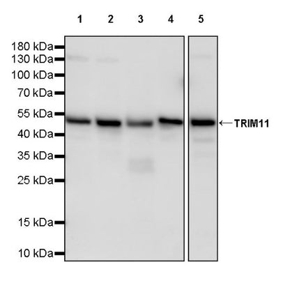 TRIM11 Recombinant Rabbit mAb (S-2960-11)