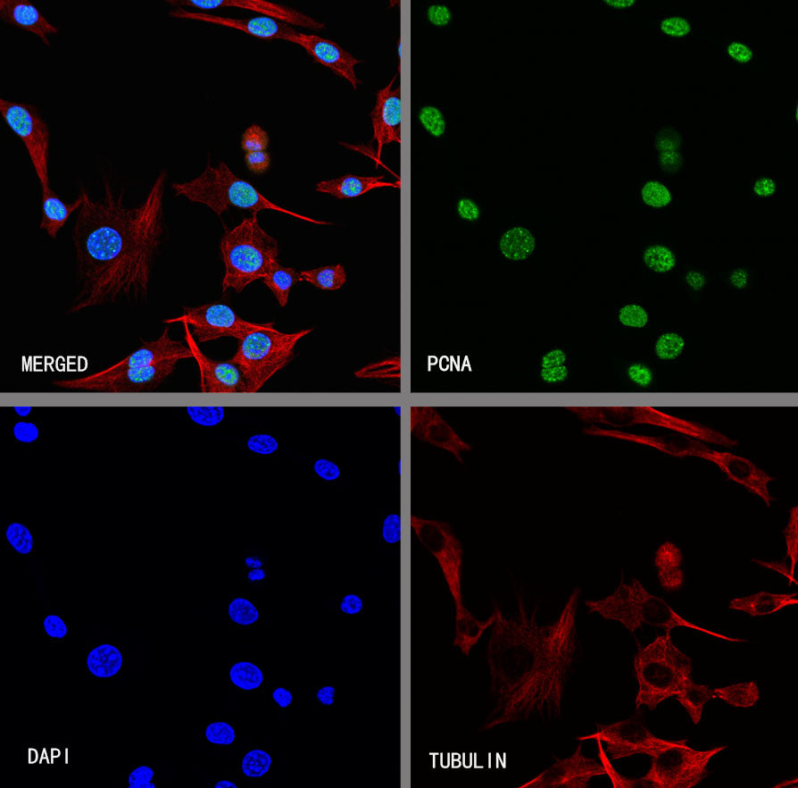 PCNA Recombinant Rabbit mAb (S-5313)