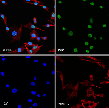PCNA Recombinant Rabbit mAb (S-5313)
