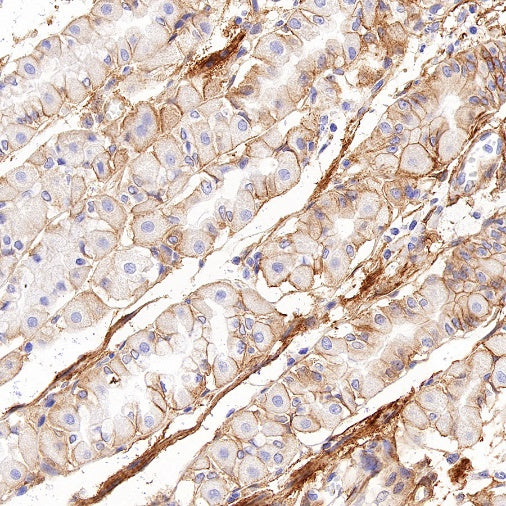 Integrin alpha V Recombinant Rabbit mAb (S-1798-27)