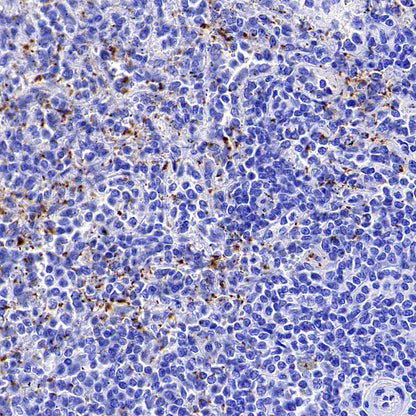 Thrombospondin 1 Recombinant Rabbit mAb (S-4153-22)