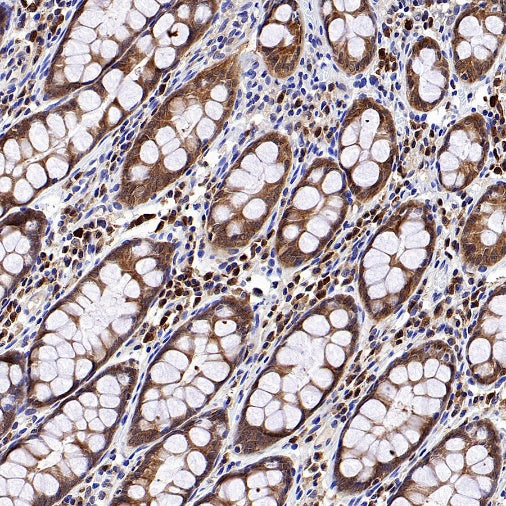 Caspase-3 Recombinant Rabbit mAb (S-656-43)