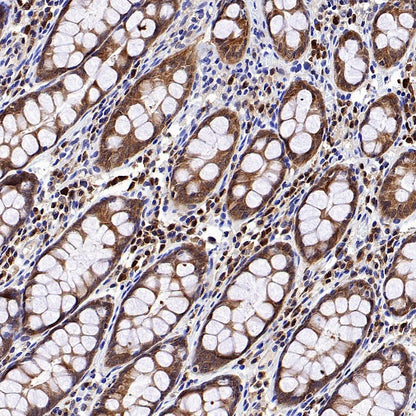 Caspase-3 Recombinant Rabbit mAb (S-656-43)