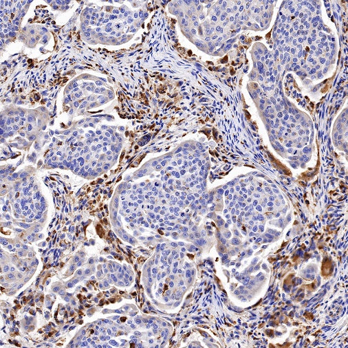 Cathepsin B Recombinant Rabbit mAb (S-1067-7)