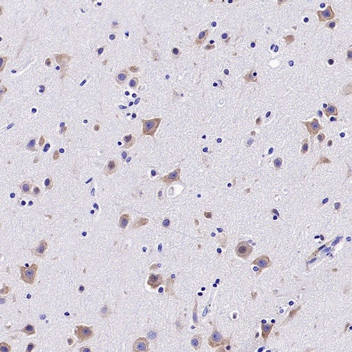 YTHDF1 Recombinant Rabbit mAb (S-3433-13)