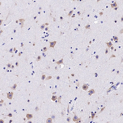 YTHDF1 Recombinant Rabbit mAb (S-3433-13)