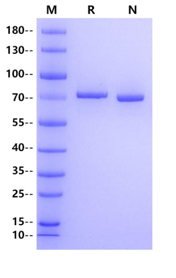ACSS3 His Tag Protein, Human