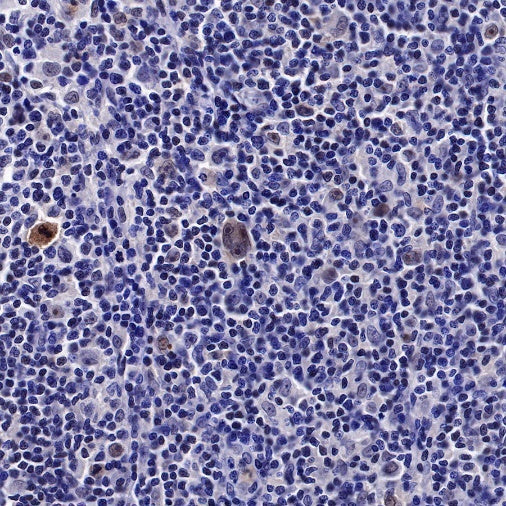 IκBα Recombinant Rabbit mAb (SDT-457-9)