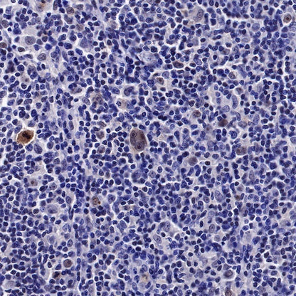 IκBα Recombinant Rabbit mAb (SDT-457-9)